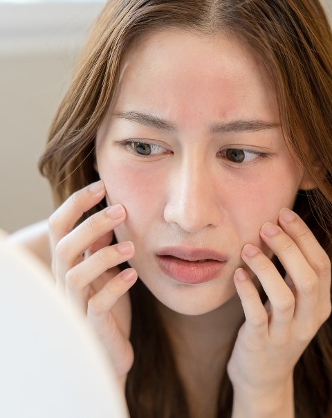 Buy Online Acne Prone Skin Care Products